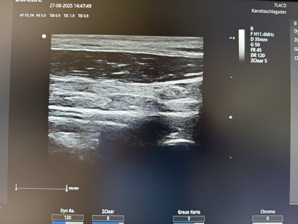 Zoncare ViV 60 Ultraschallgerät Neugerät – Bild 3