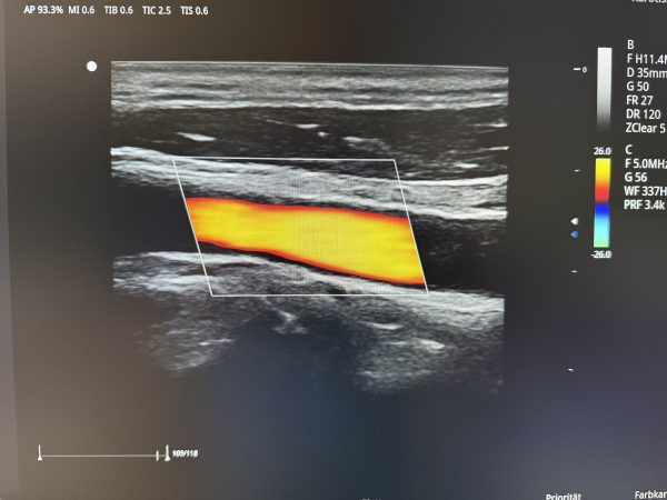 Zoncare ViV 60 Ultraschallgerät Neugerät – Bild 5