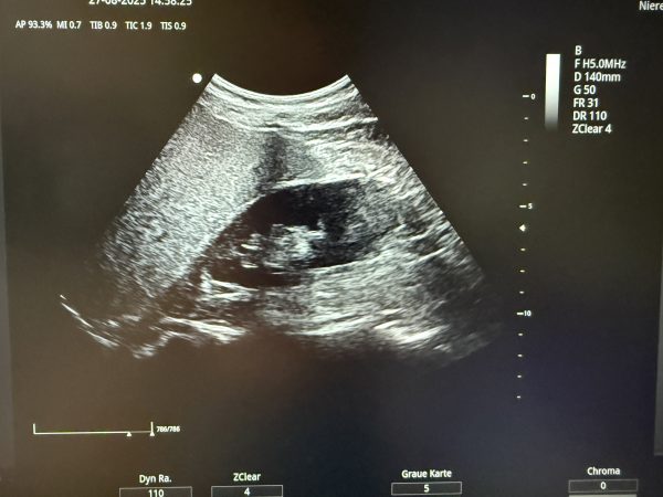 Zoncare ViV 60 Ultraschallgerät Neugerät – Bild 4