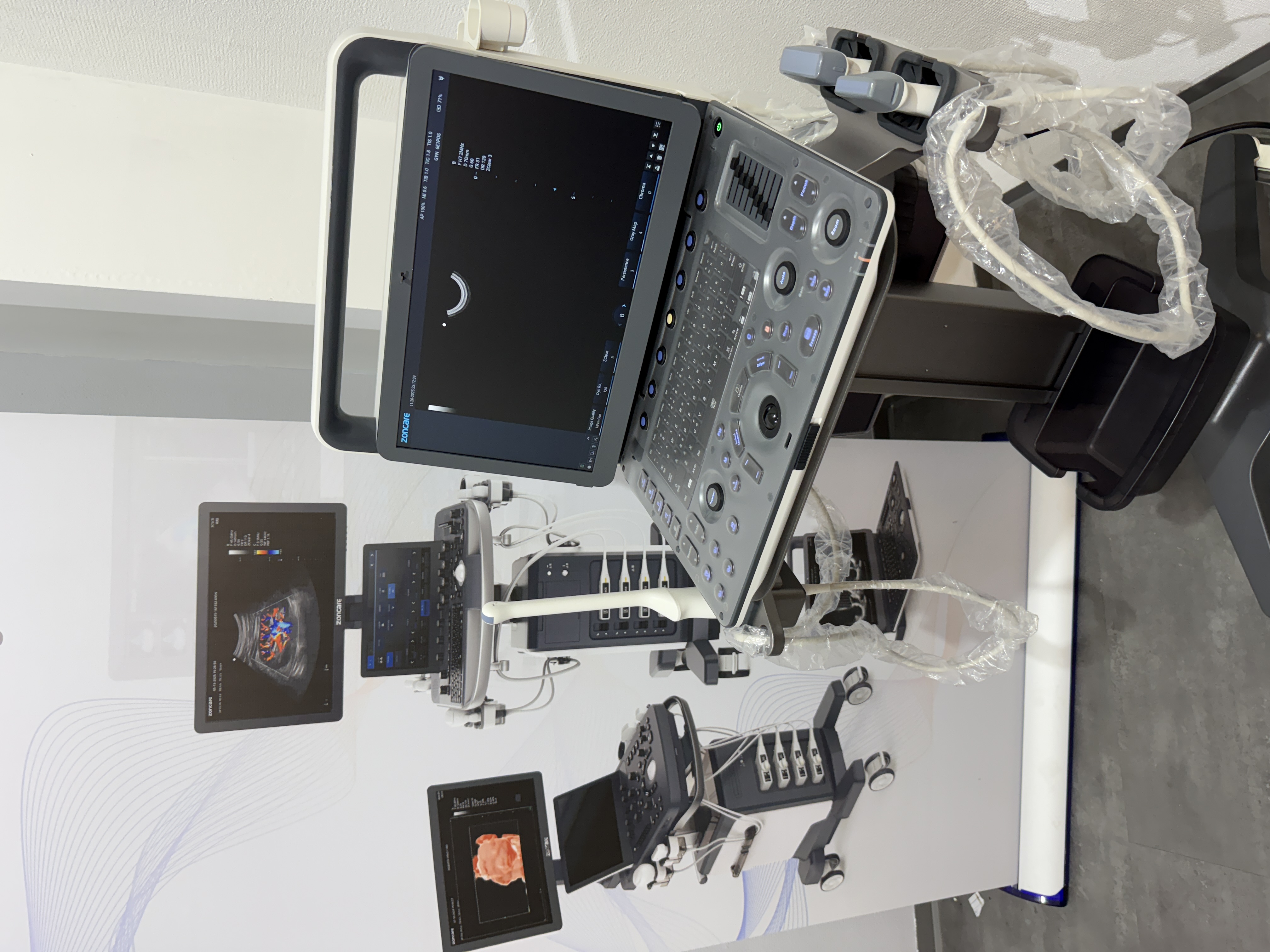 Zoncare M70 tragbares Ultraschallgerät – Bild 3