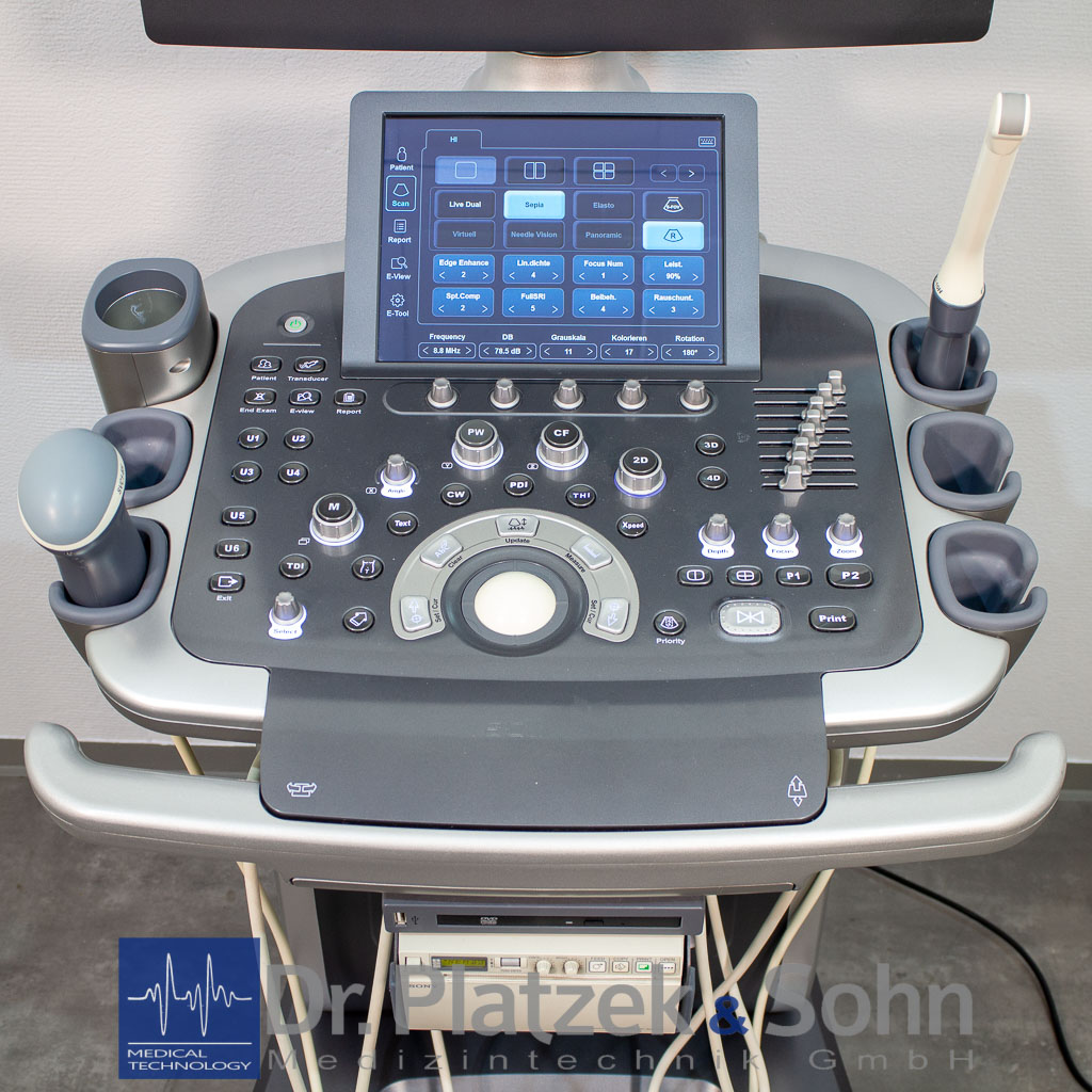 Alpinion E-Cube 11 3D/4D Ultraschallgerät Gynäkologie – Bild 2
