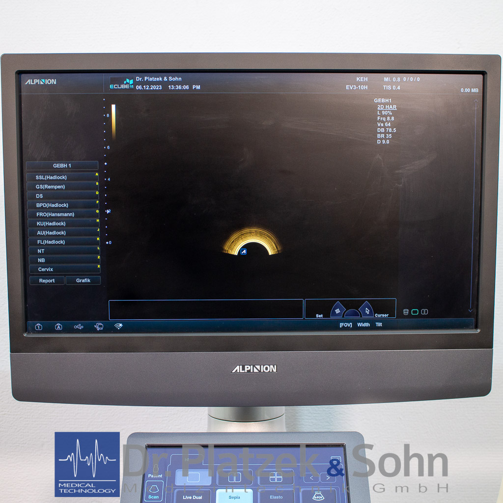 Alpinion E-Cube 11 3D/4D Ultraschallgerät Gynäkologie – Bild 5