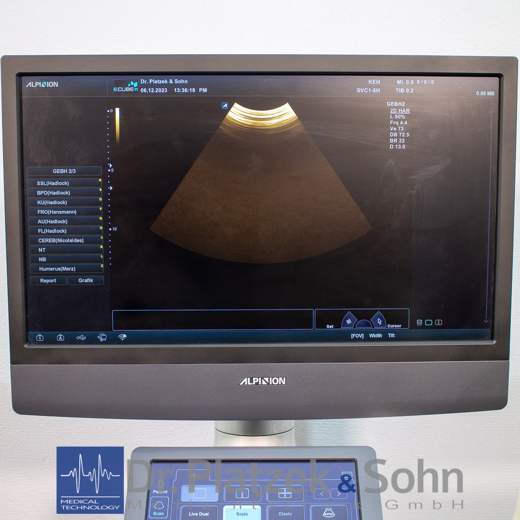 Alpinion E-Cube 11 3D/4D Ultraschallgerät Gynäkologie – Bild 6
