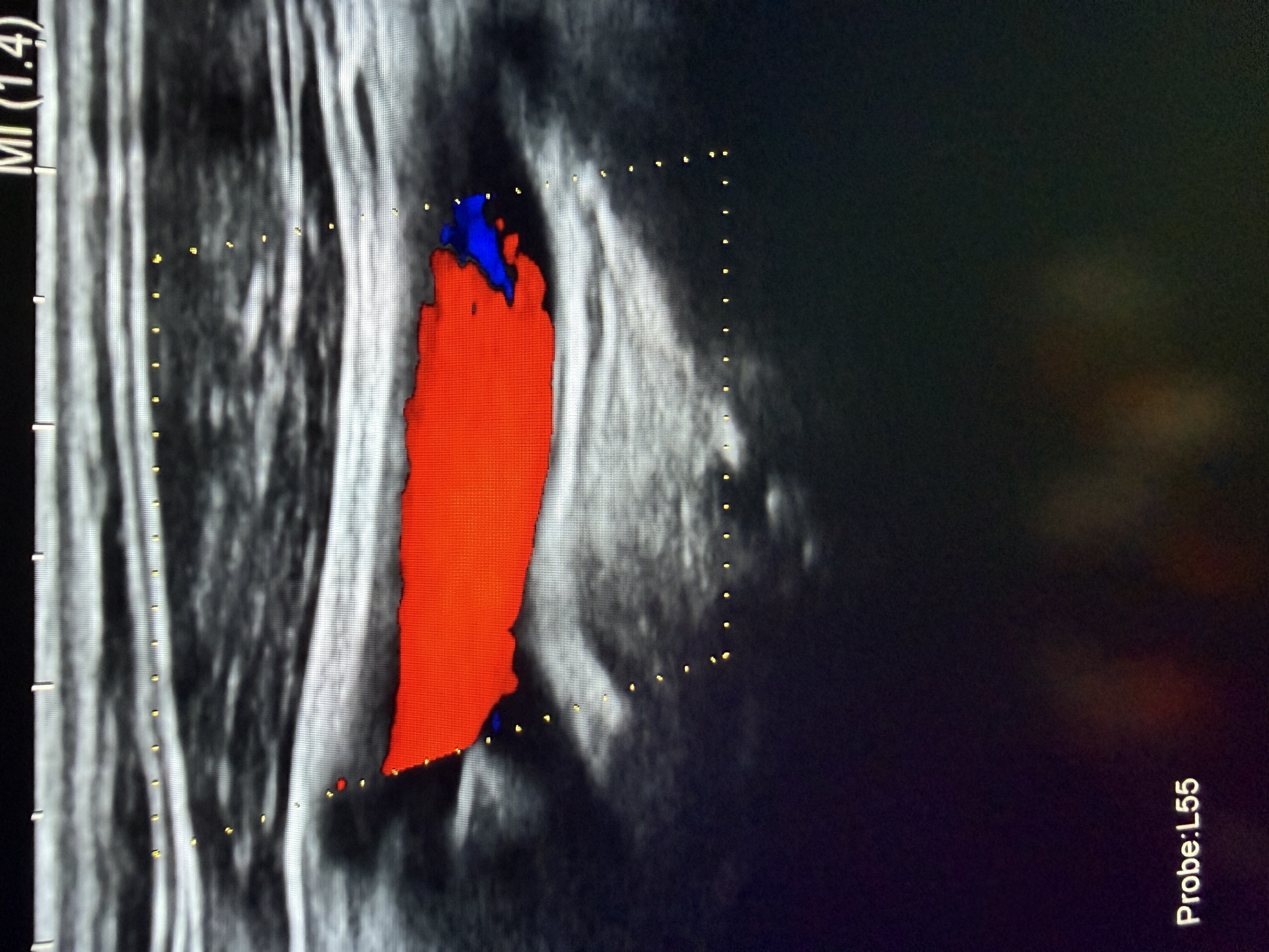 Hitachi Canon Arietta V70 Ultraschallgerät Gynäkologie – Bild 6