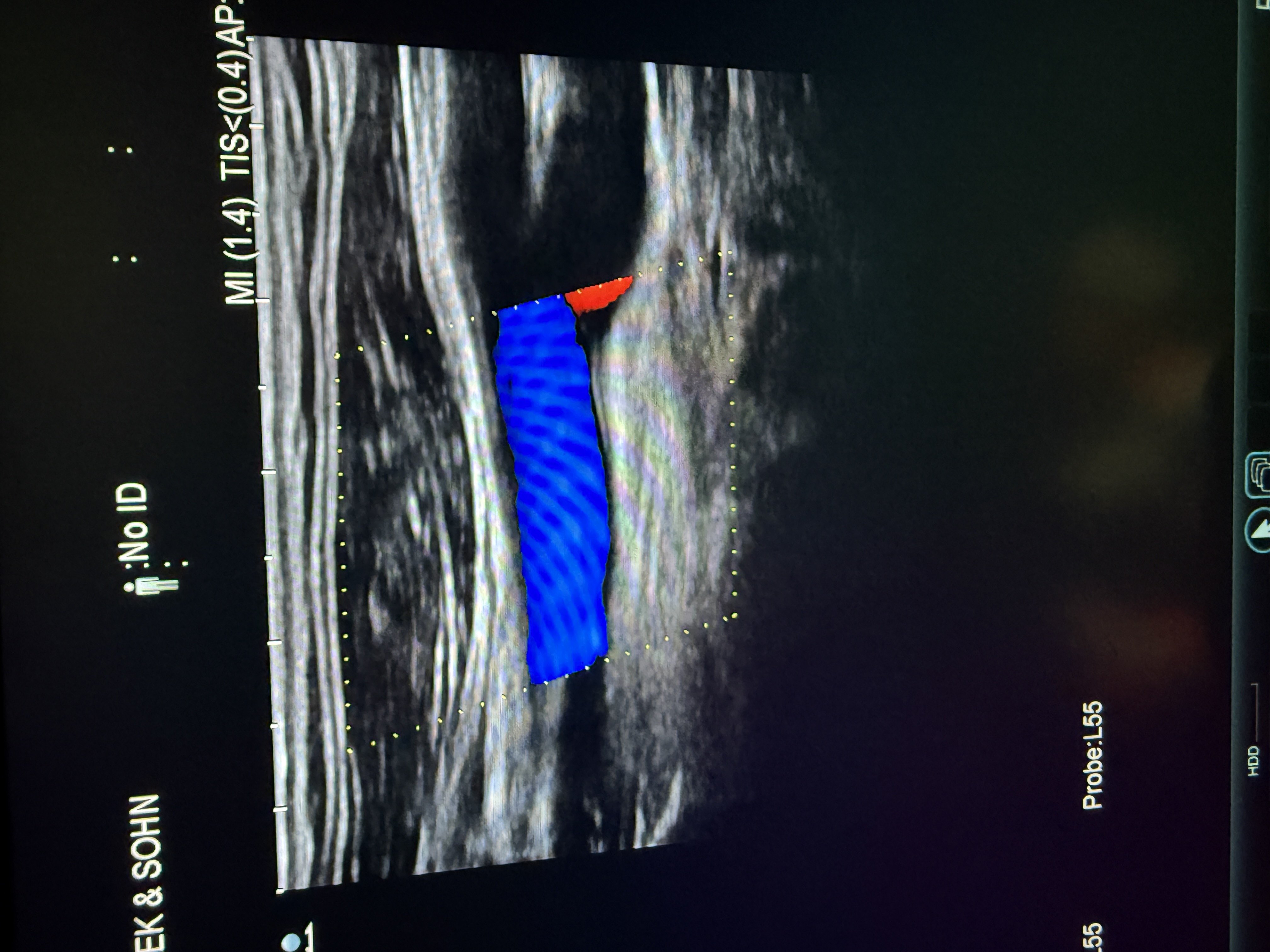 Hitachi Canon Arietta V70 Ultraschallgerät Gynäkologie – Bild 7