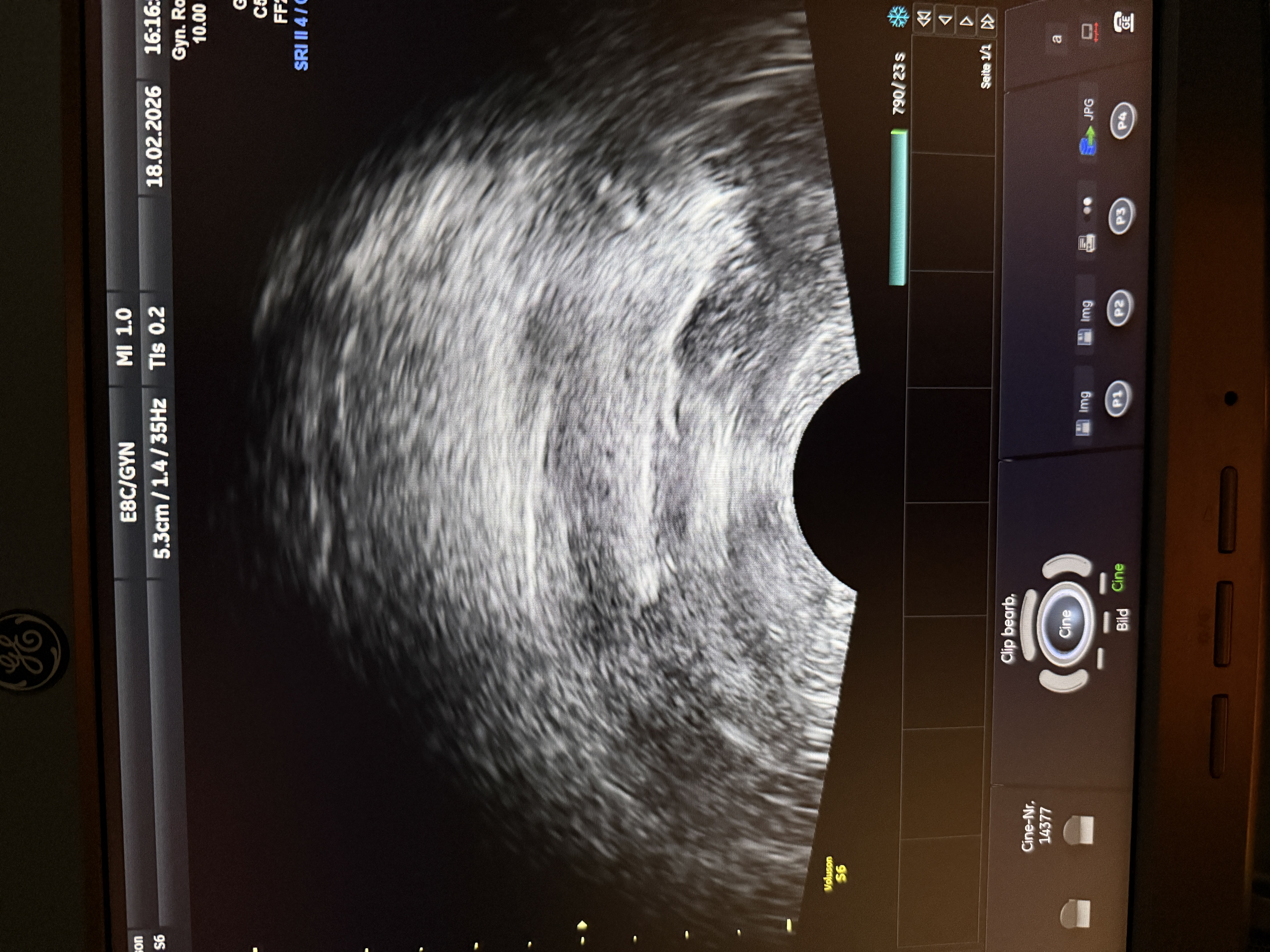 GE Voluson S6 Ultraschallgerät Gyn – Bild 3