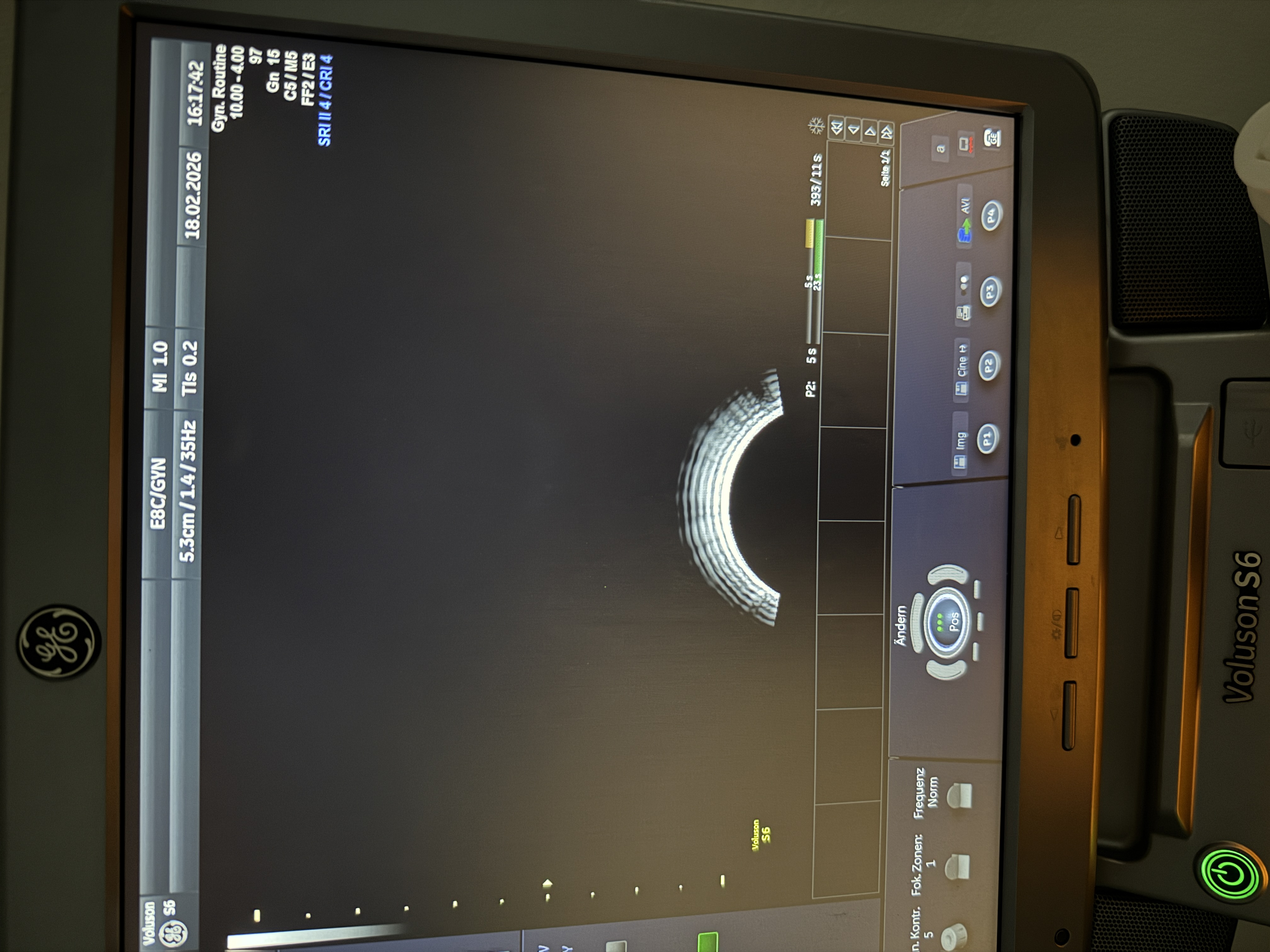 GE Voluson S6 Ultraschallgerät Gyn – Bild 4