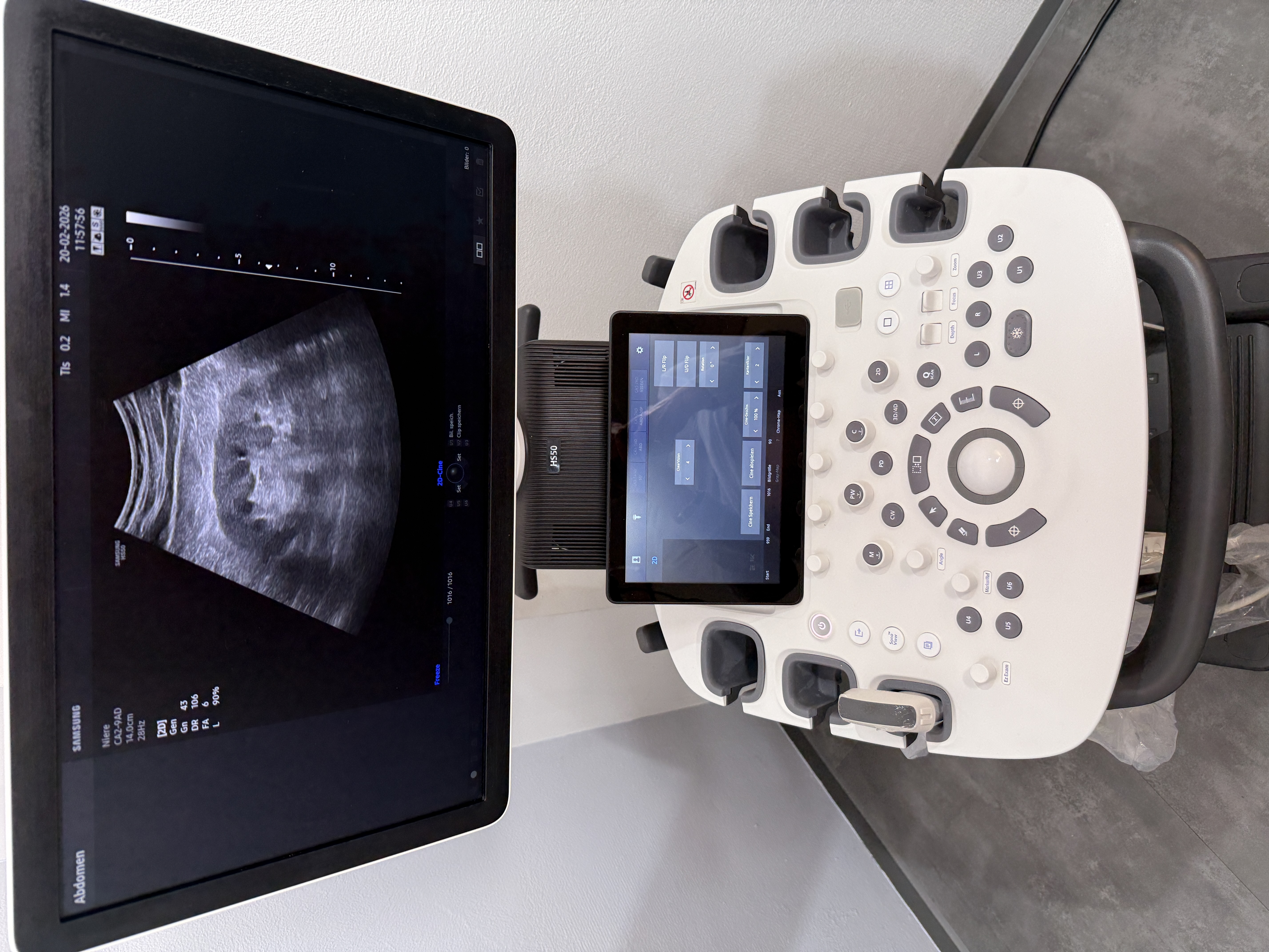 Samsung HS50 Ultraschallgerät – Bild 4