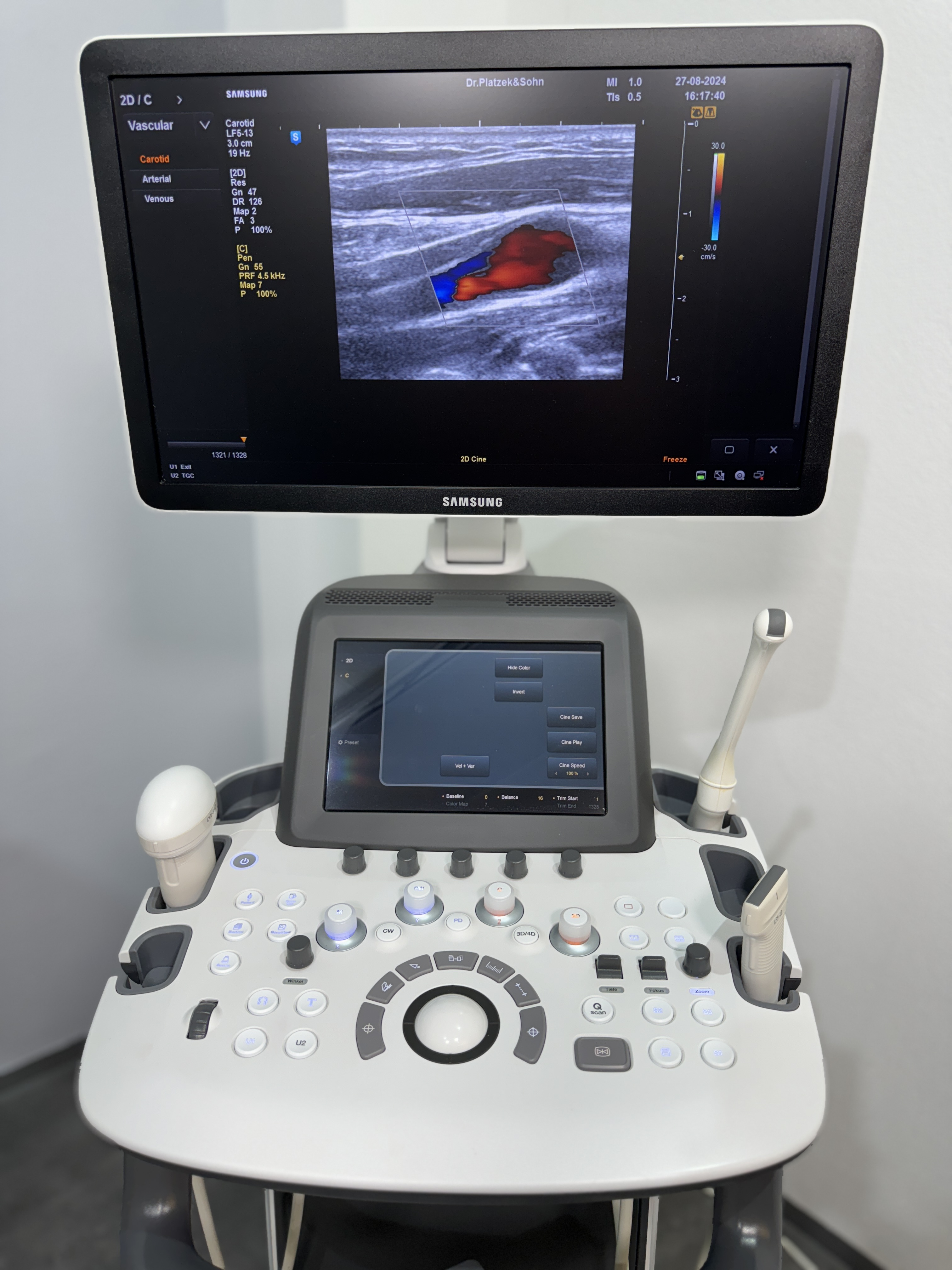 Samsung H60 Ultraschallgerät Gynäkologie – Bild 2