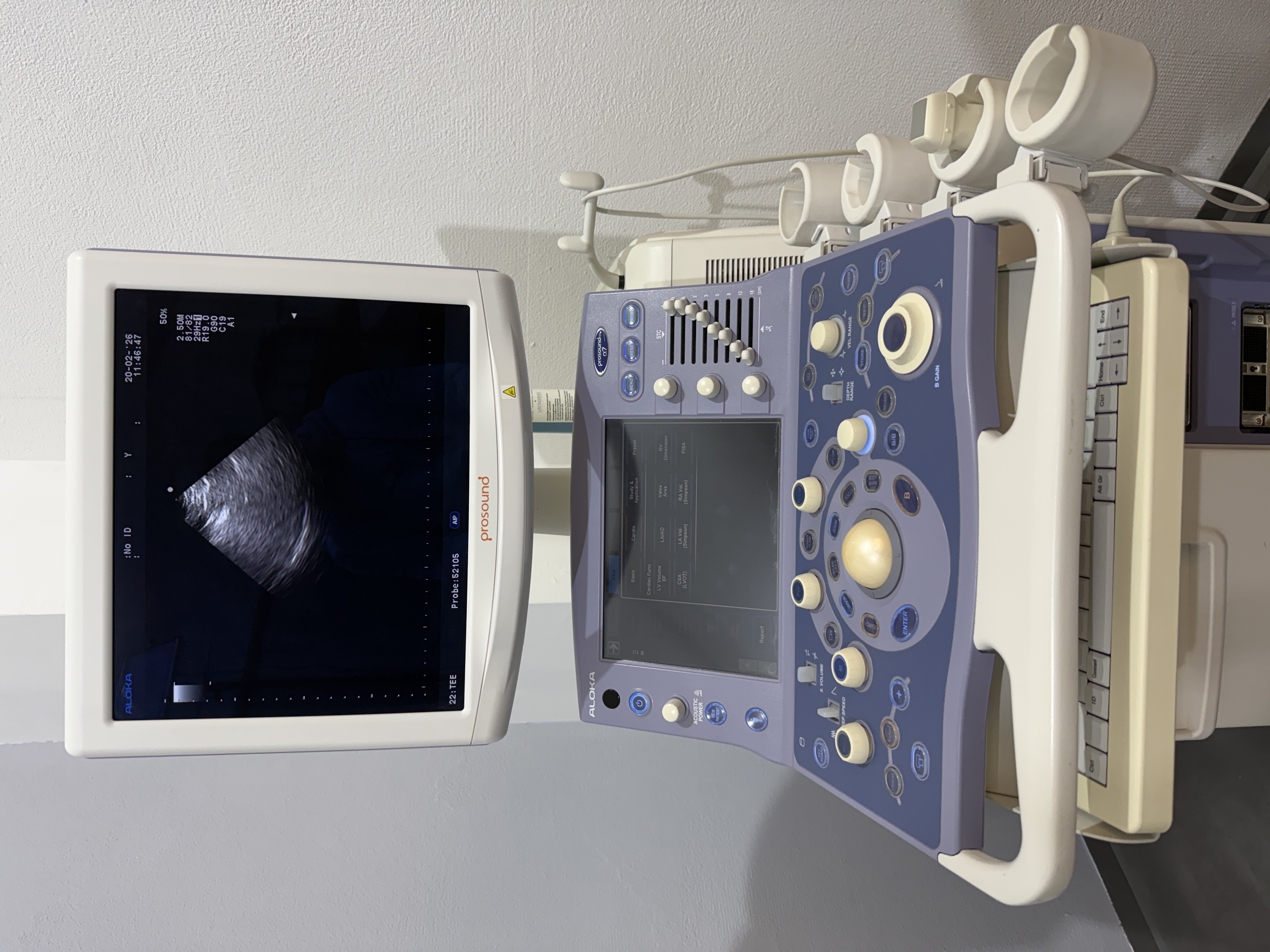 Aloka alpha 7 Ultraschallgerät Kardio – Bild 2