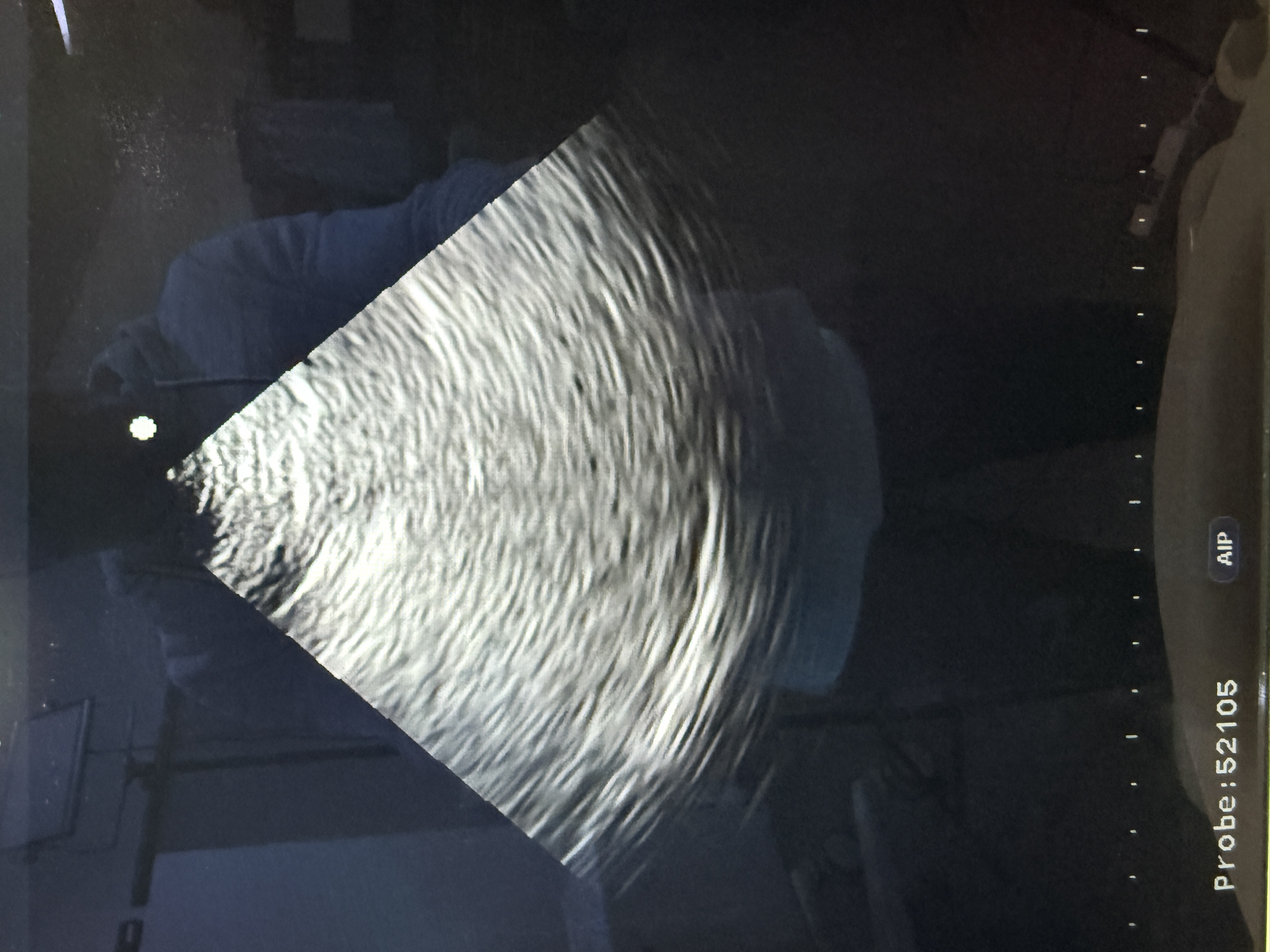 Aloka alpha 7 Ultraschallgerät Kardio – Bild 5