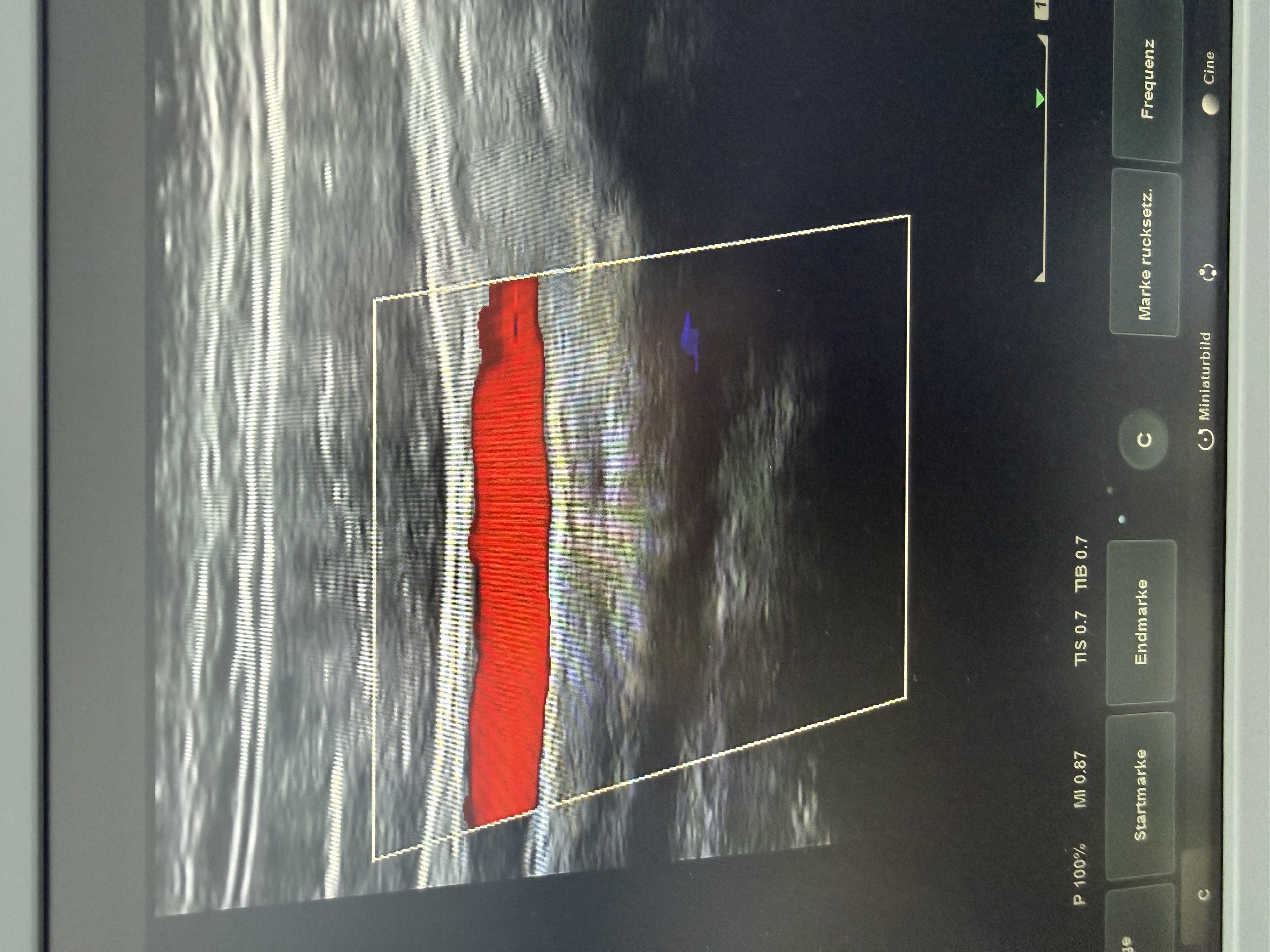 Siemens Acuson NX2 Ultraschallgerät Kardiologie – Bild 5