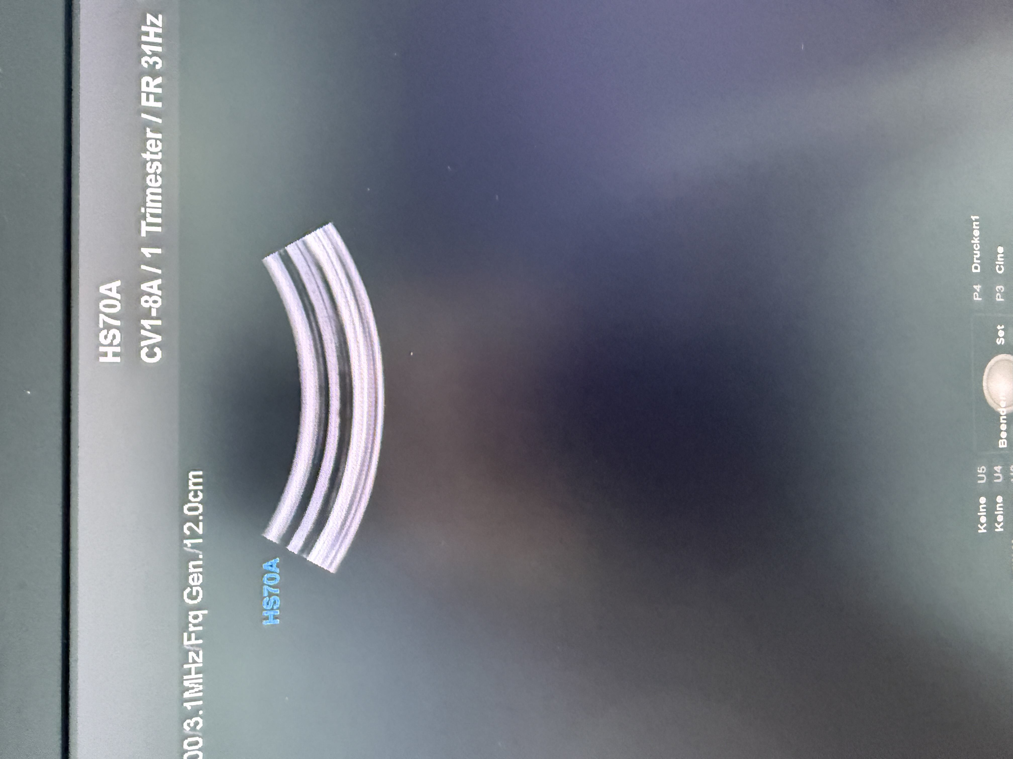 Samsung HS70A Ultraschallgerät Gynäkologie – Bild 2