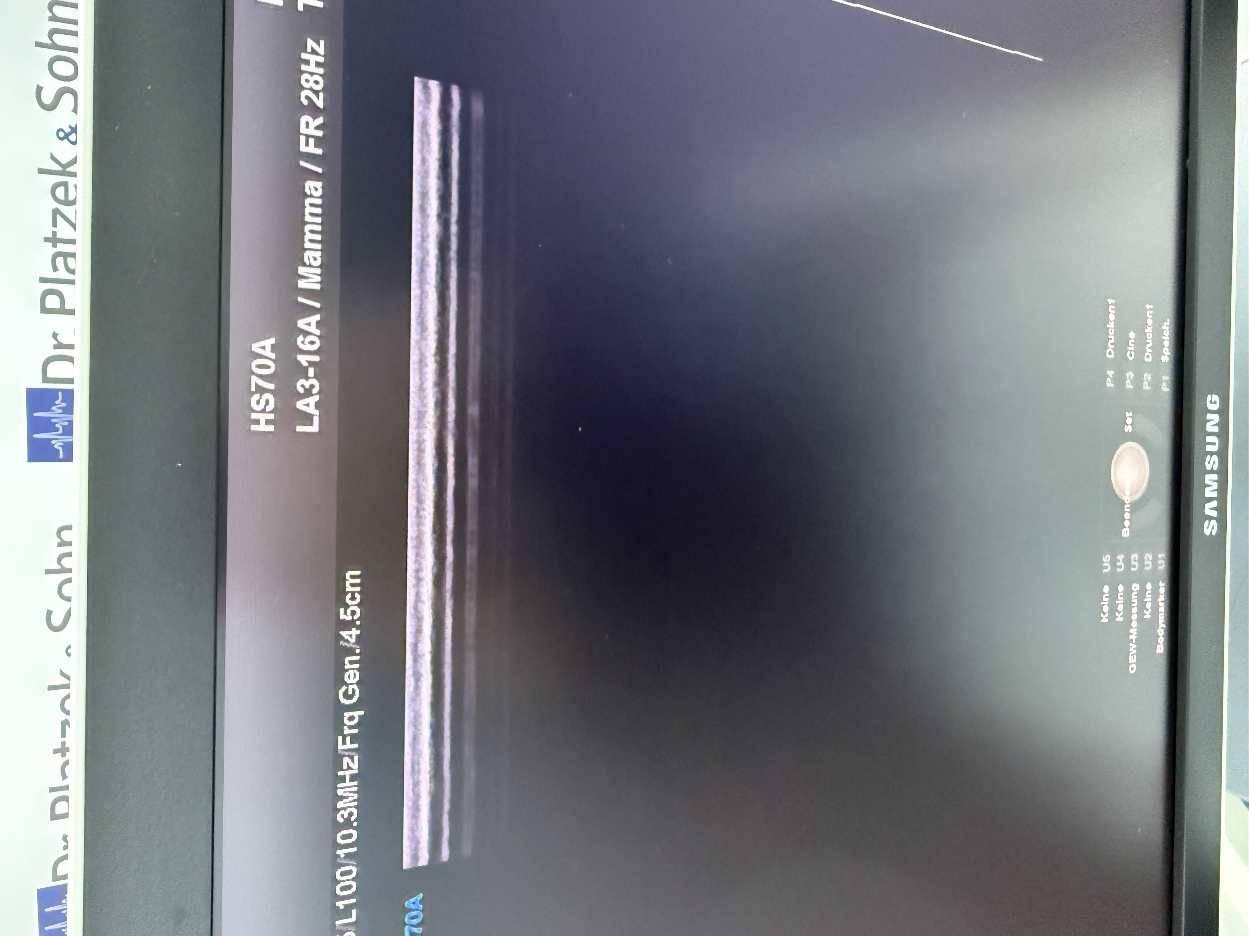 Samsung HS70A Ultraschallgerät Gynäkologie – Bild 3