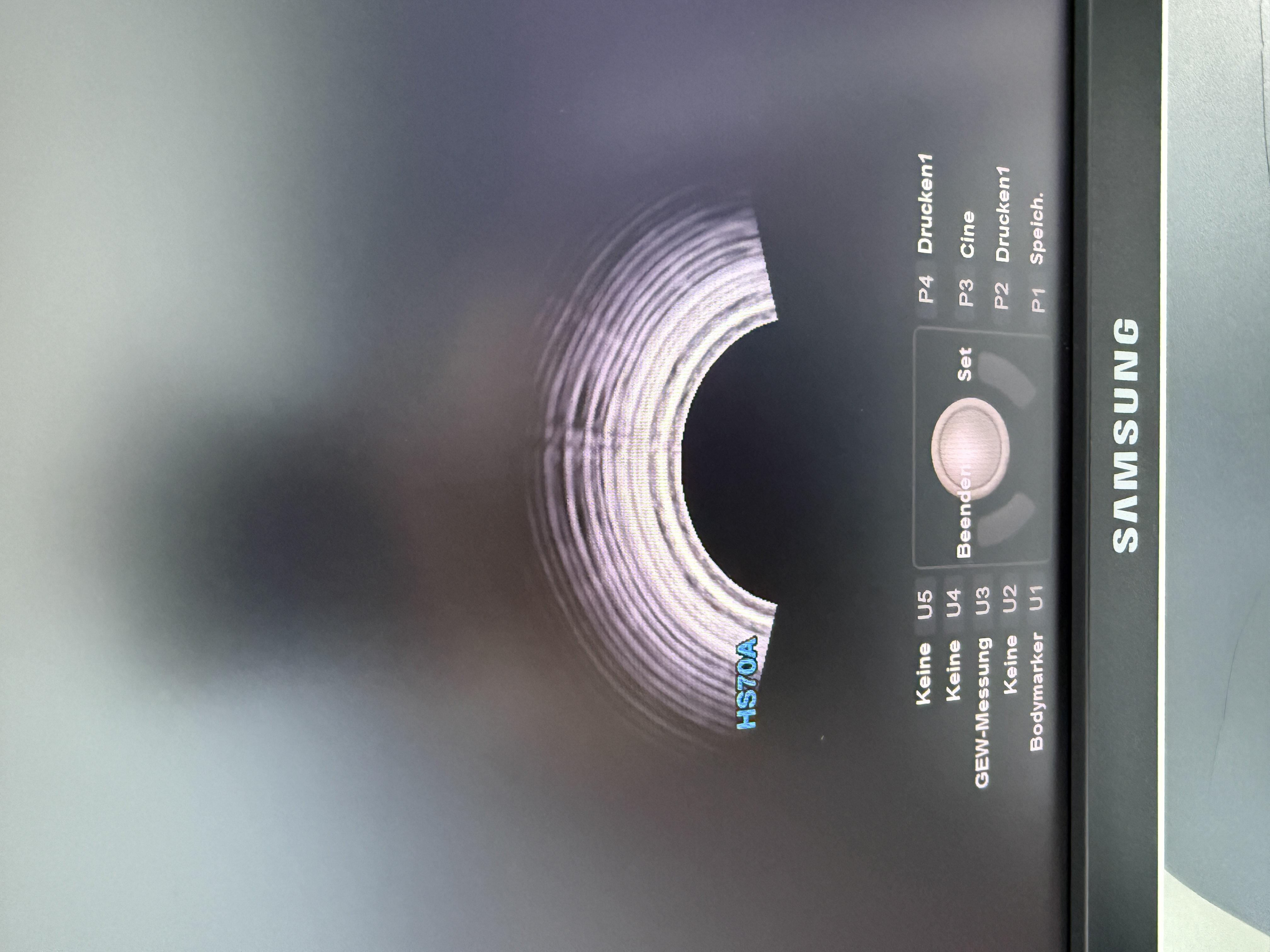 Samsung HS70A Ultraschallgerät Gynäkologie – Bild 4