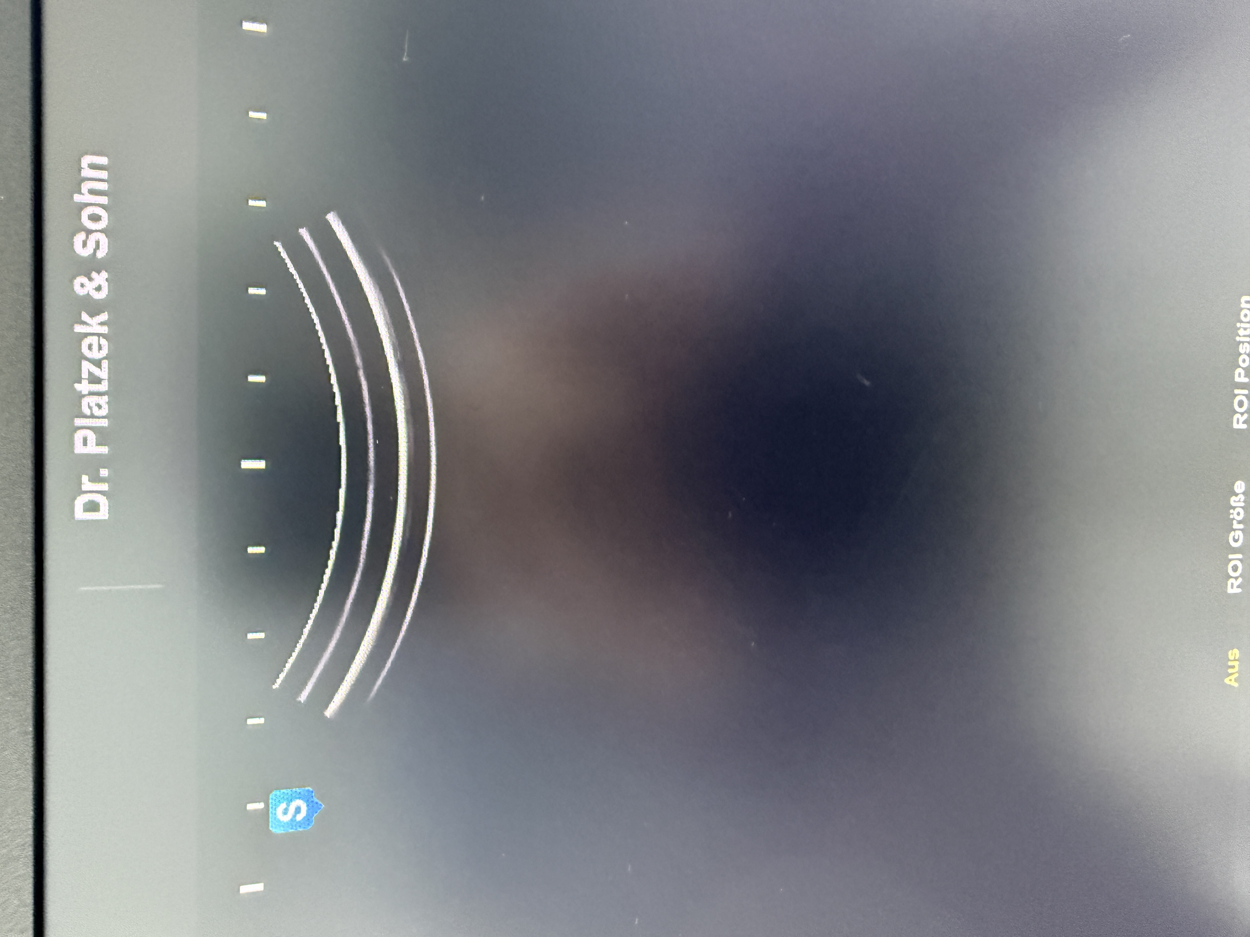 Samsung H60 Ultraschallgerät Gynäkologie – Bild 3