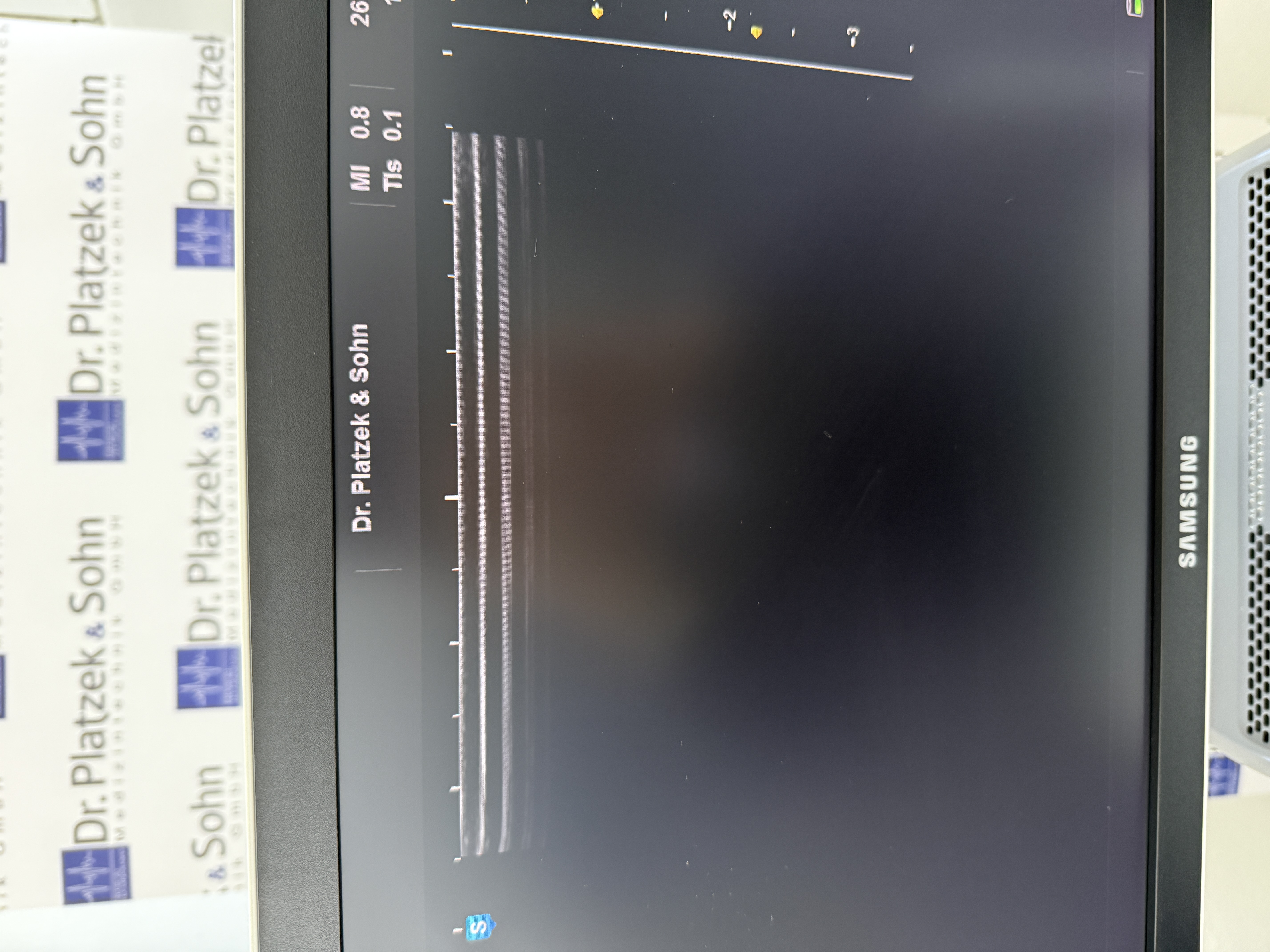 Samsung H60 Ultraschallgerät Gynäkologie – Bild 4