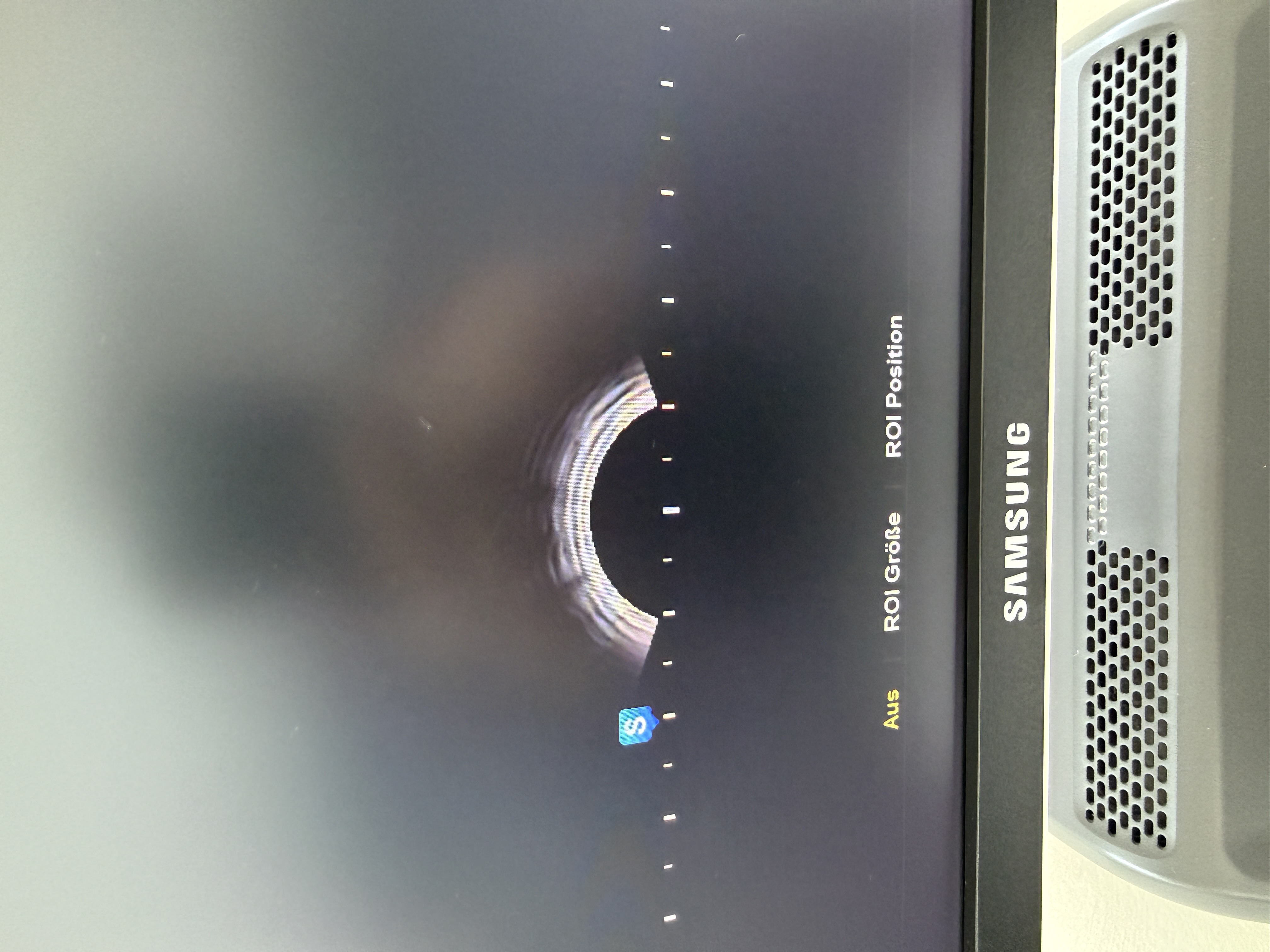 Samsung H60 Ultraschallgerät Gynäkologie – Bild 5