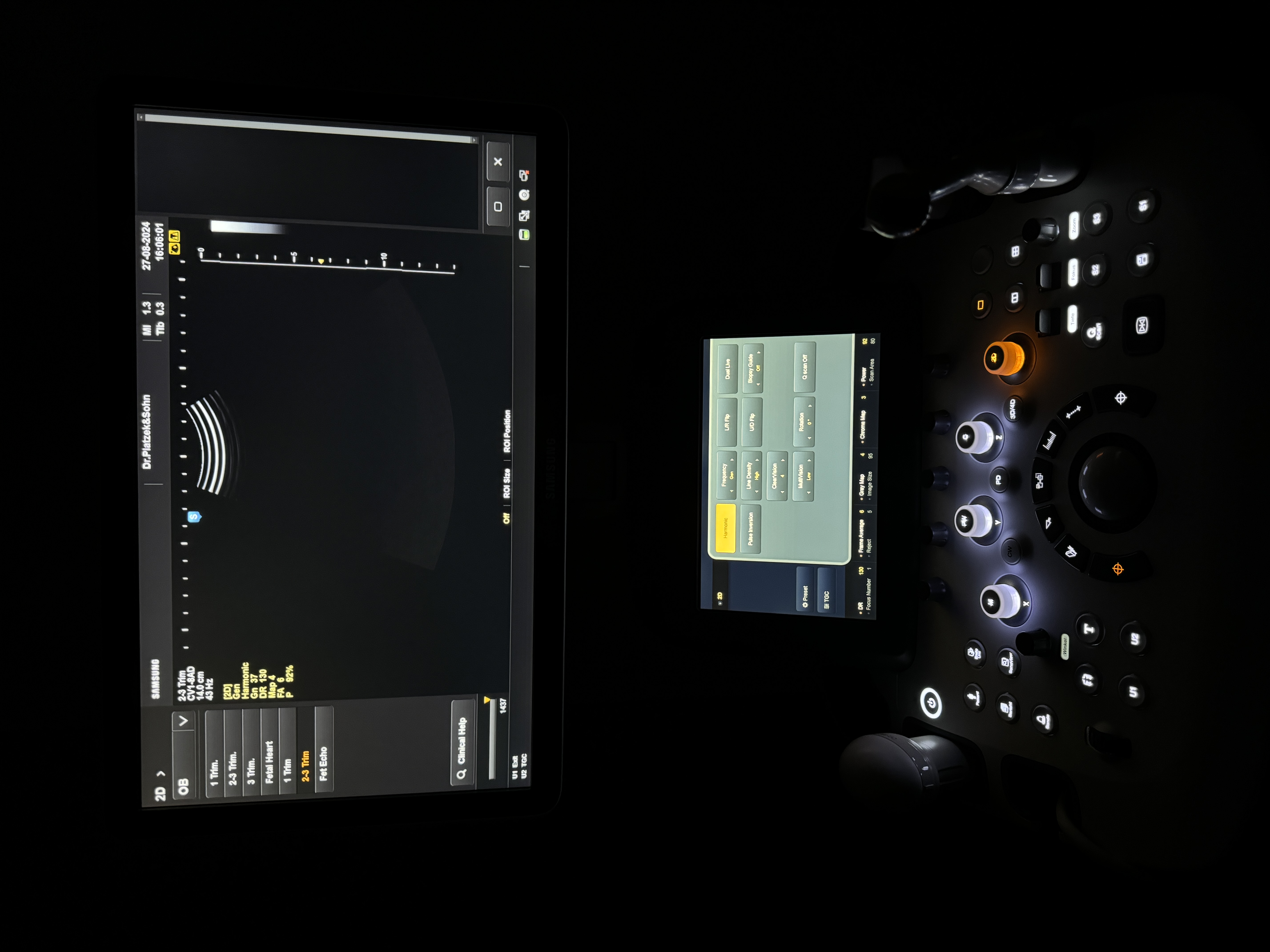 Samsung Ugeo H60 Ultraschallgerät Gynäkologie – Bild 10