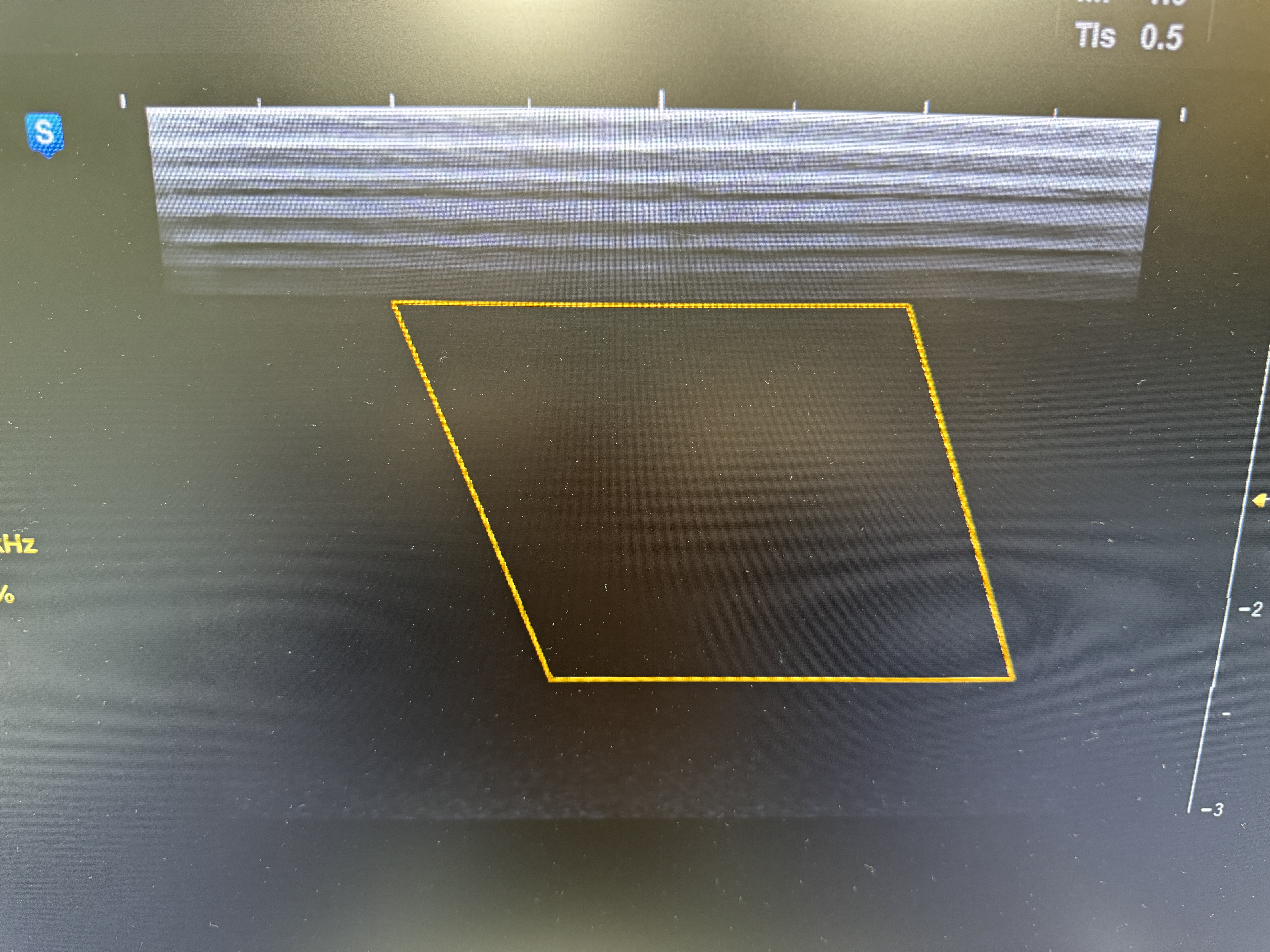 Samsung Ugeo H60 Ultraschallgerät Gynäkologie – Bild 9