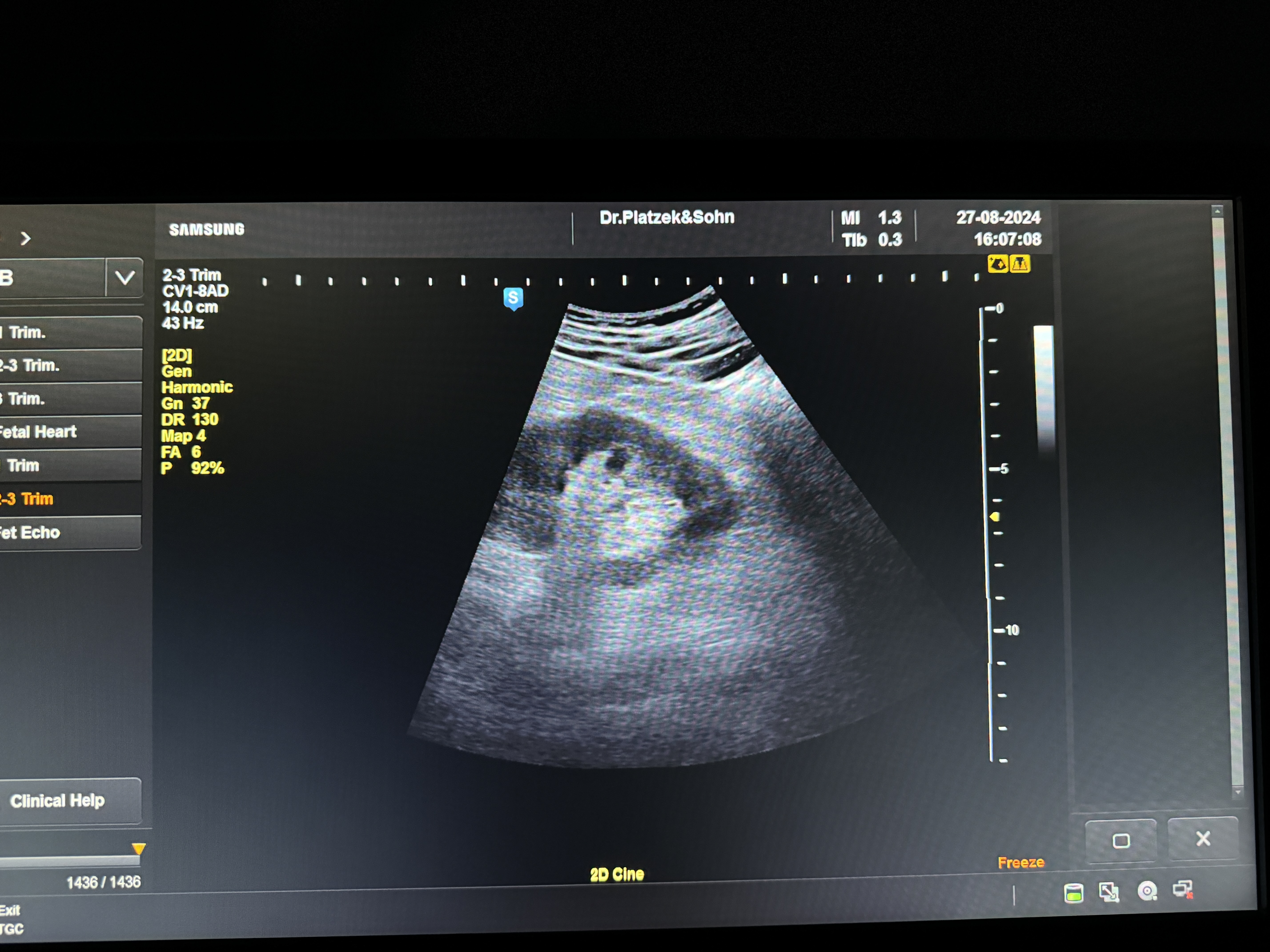 Samsung Ugeo H60 Ultraschallgerät Gynäkologie – Bild 8