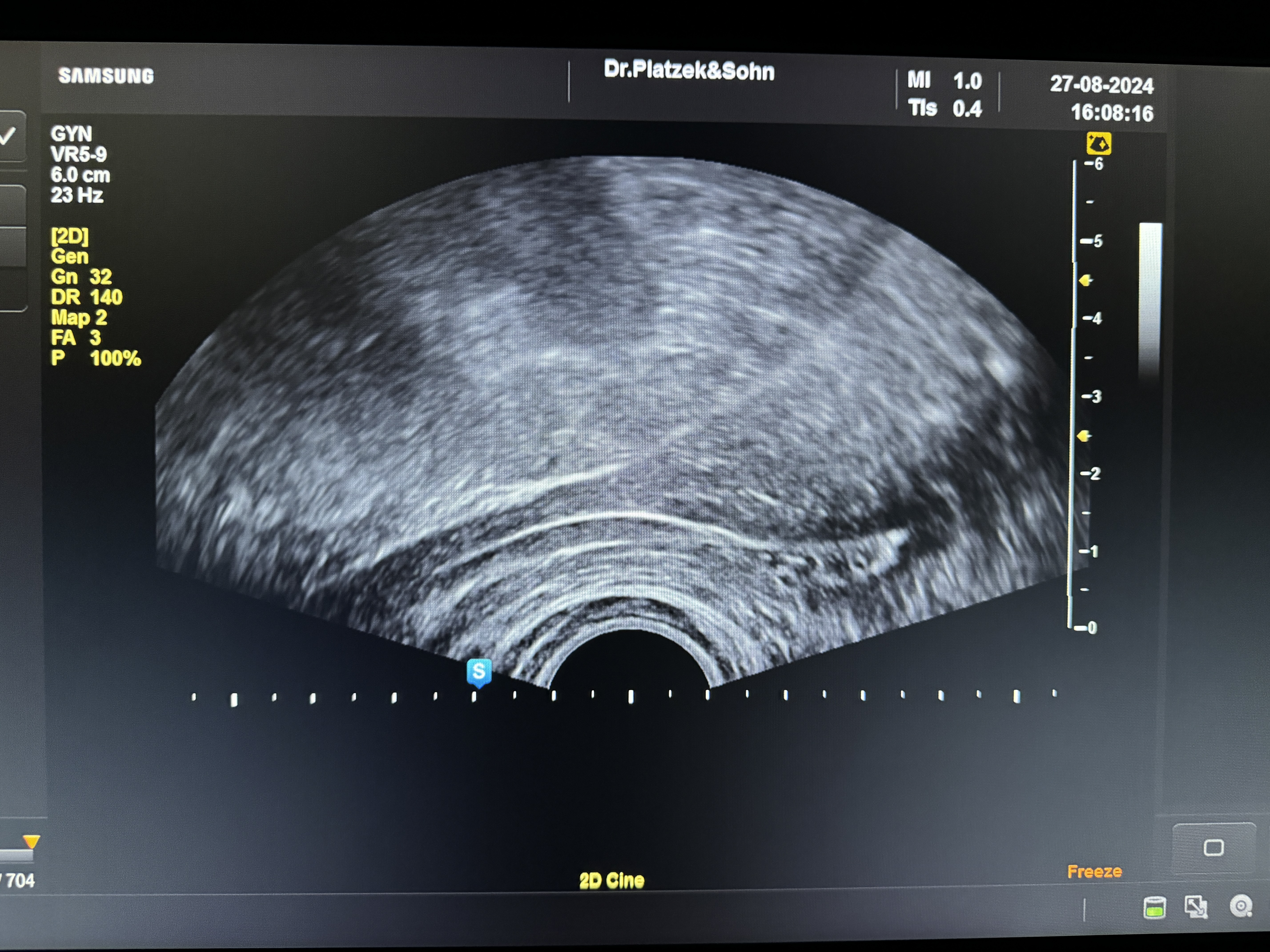 Samsung Ugeo H60 Ultraschallgerät Gynäkologie – Bild 7