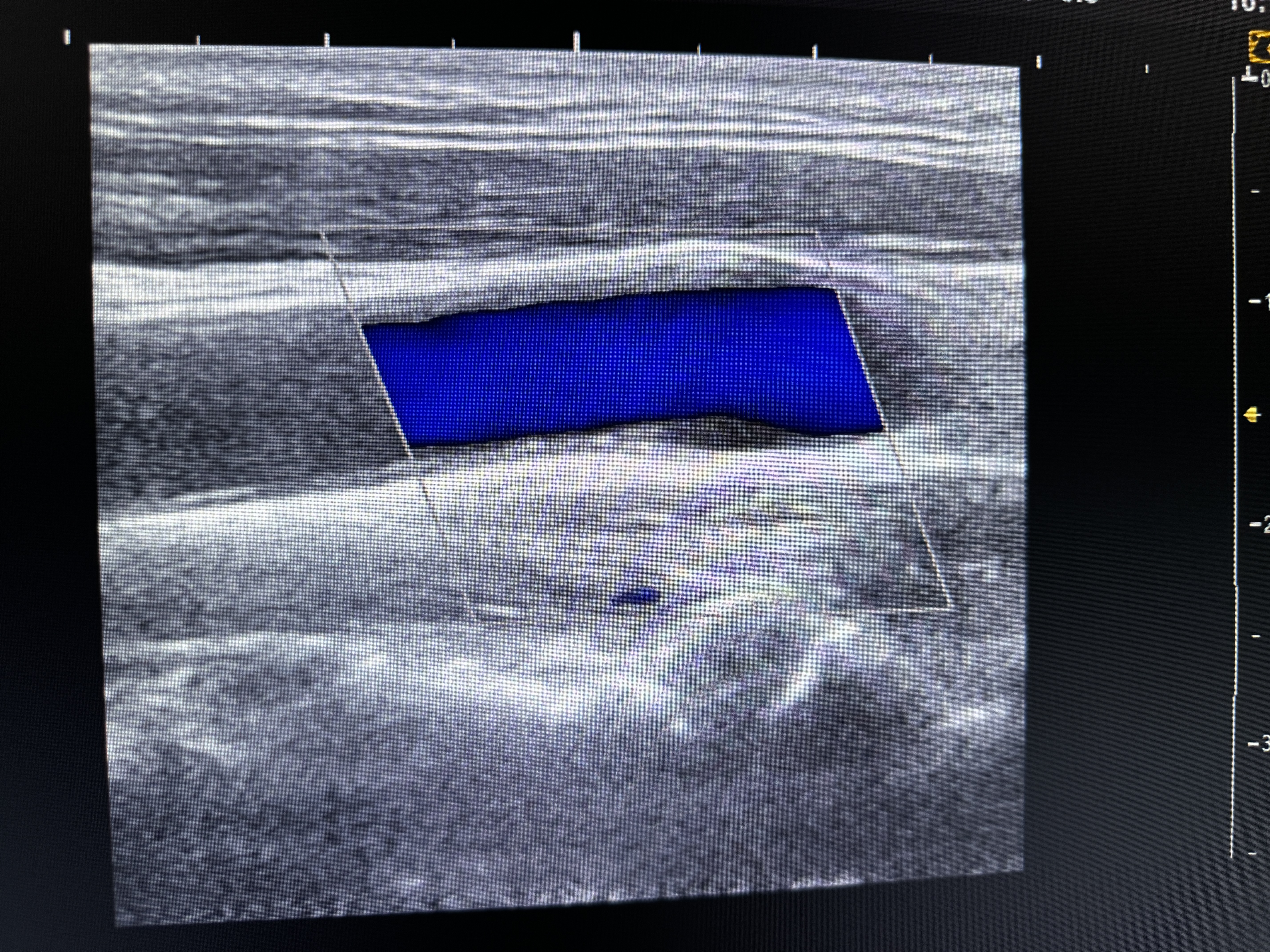 Samsung Ugeo H60 Ultraschallgerät Gynäkologie – Bild 6